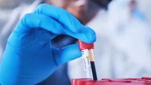 New Blood Test Can Predict Diseases Up to Ten Years Early