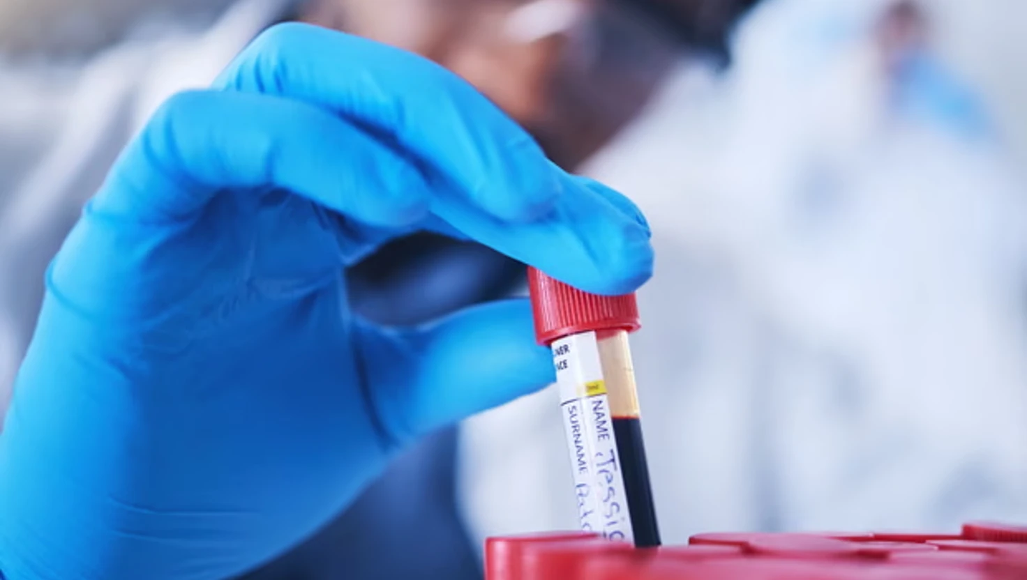 New Blood Test Can Predict Diseases Up to Ten Years Early