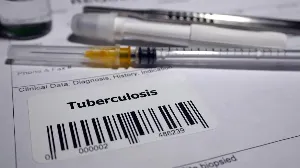 Drones Cut Tuberculosis Diagnosis Time from 15 to 5 Days in Telangana