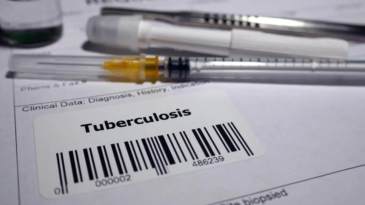 Drones Cut Tuberculosis Diagnosis Time from 15 to 5 Days in Telangana