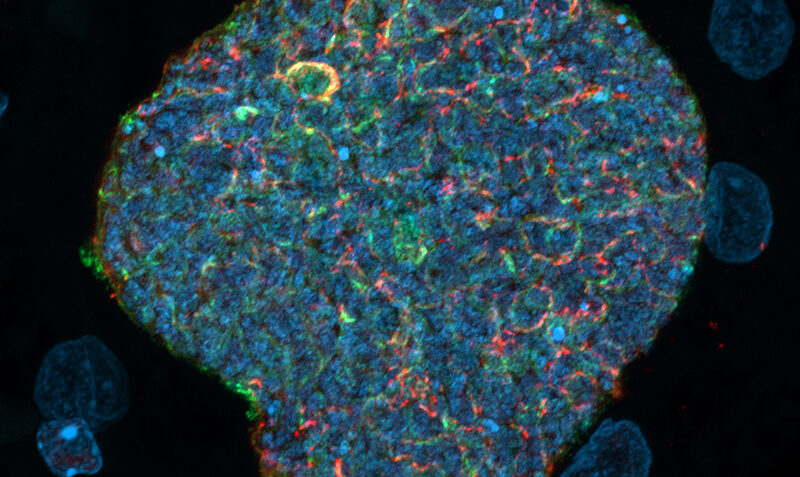 Innovative Research Turns Mosquito Bites into Malaria Immunity Boosters