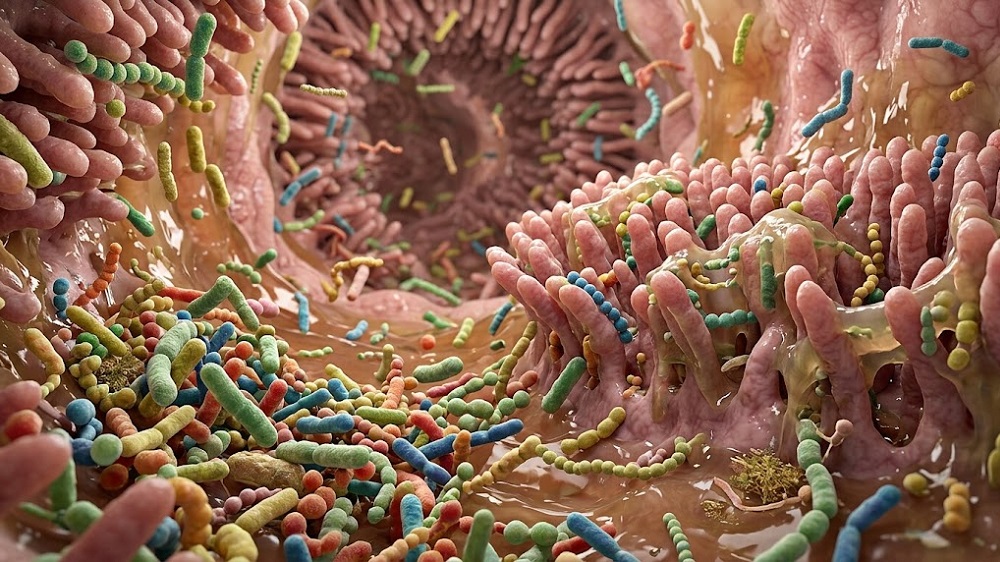 Fatty Acid from Gut Bacteria Shows Potential Against Atherosclerosis
